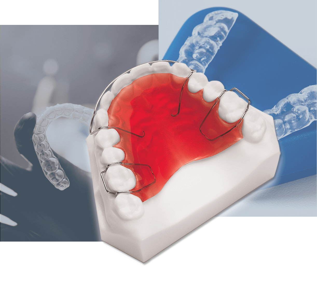 スポーツマウスガードの製作 矯正装置各種製作(スキャンデータ・石膏模型対応)